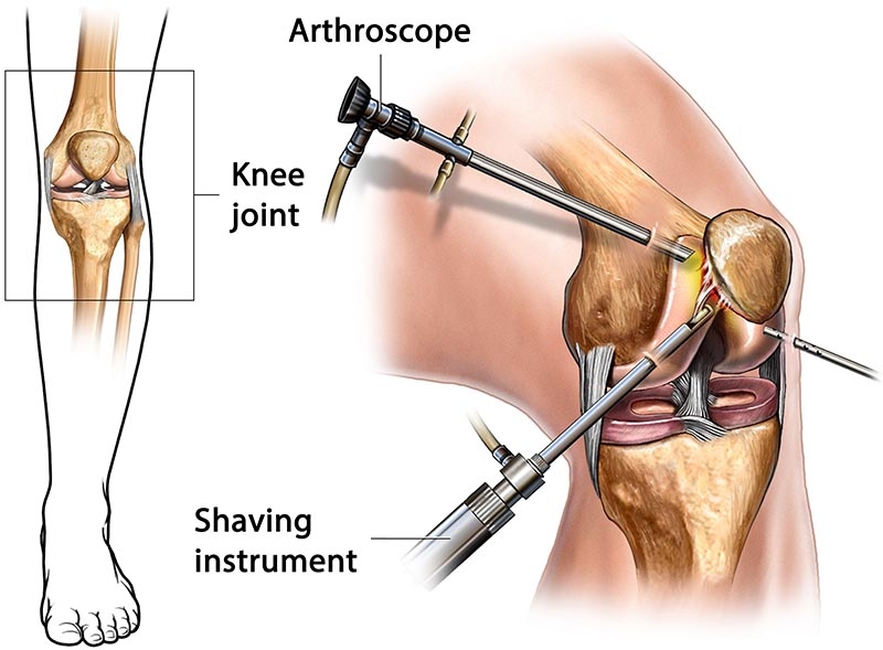kinematic_alignment kinematic_alignment